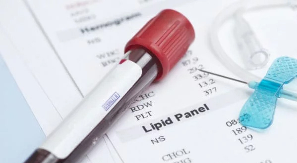 analisis de colesterol farmacia lopez castillo